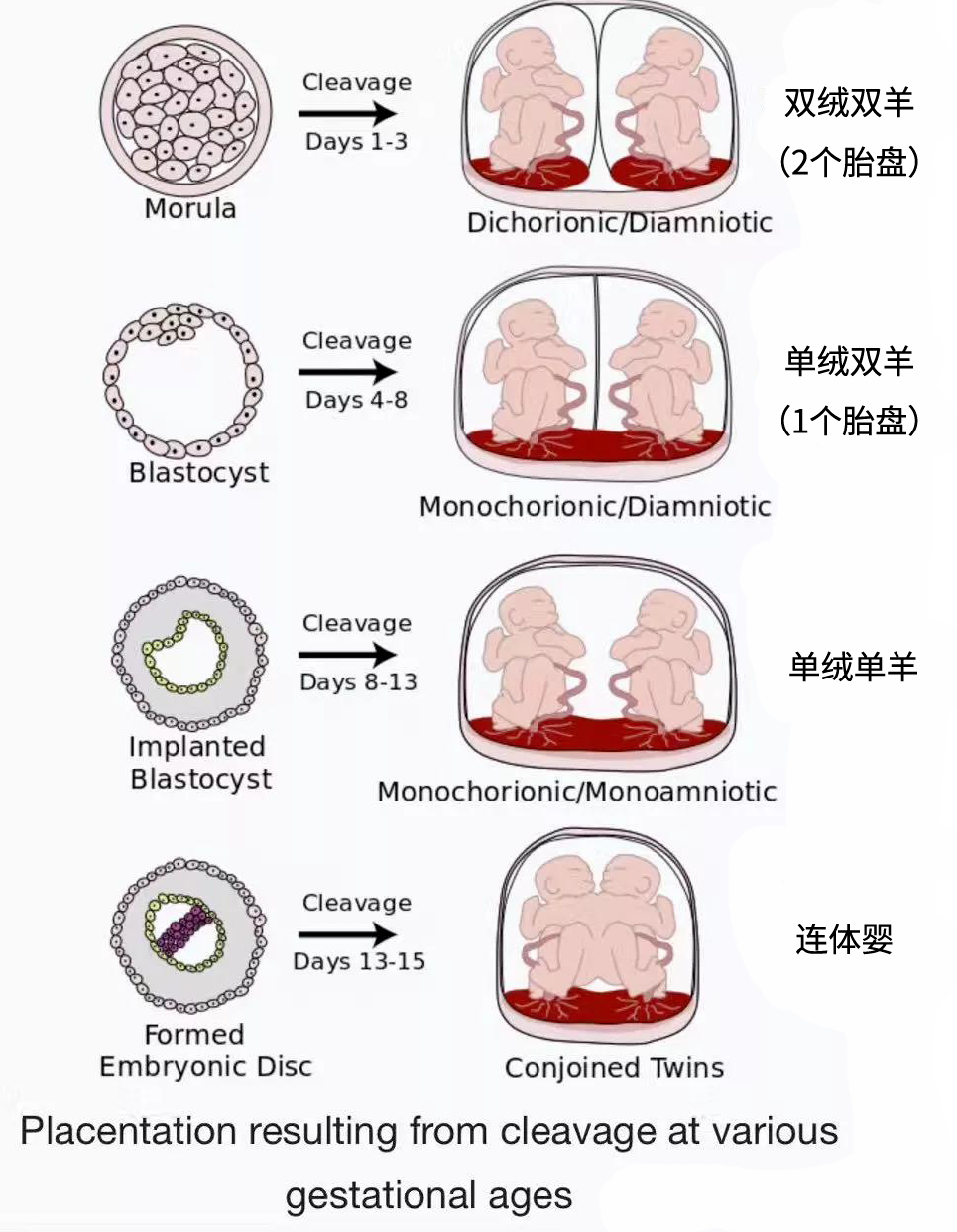 做试管，移植两个胚胎就一定能怀双胞胎？