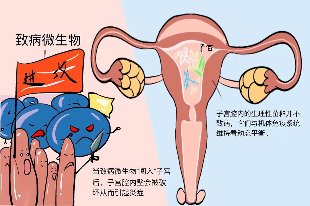 小心！这个无症状疾病正在影响你的试管成功率