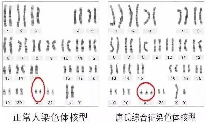 男性高龄，会导致精子碎片率迅速上升！