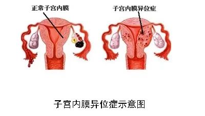 排卵正常却没怀上？可能是ta出问题了！