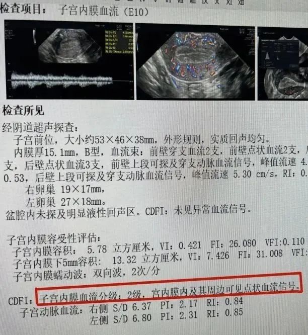 试管总失败，建议查一下子宫动脉血流！