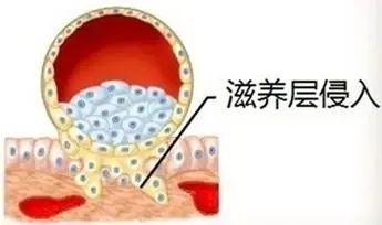 再好的胚胎内膜，不解决这个问题也白搭！