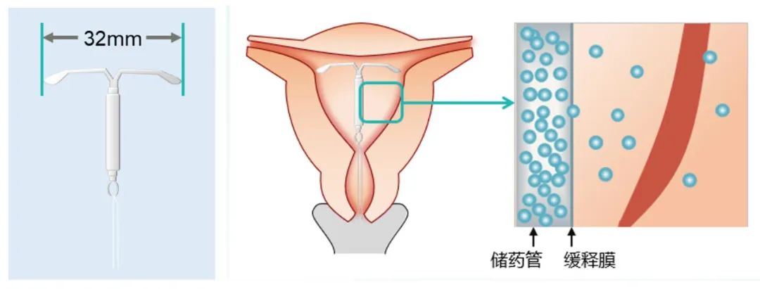 痛经真的会痛到死？有没有治疗方法？