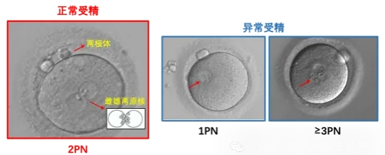 试管婴儿中为什么解冻后的胚胎还会掉等级？