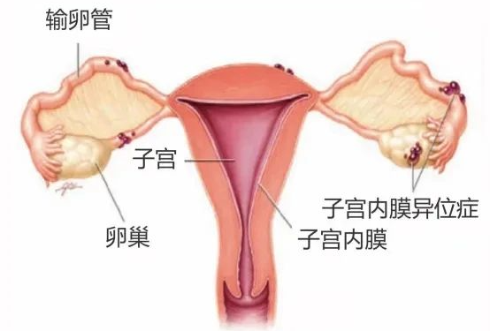 痛经真的会痛到死？有没有治疗方法？