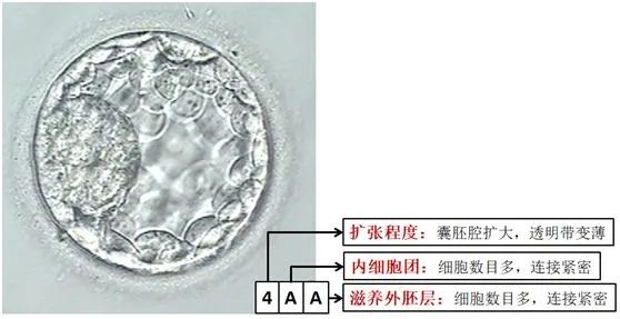 低质量囊胚，还有移植的必要吗？