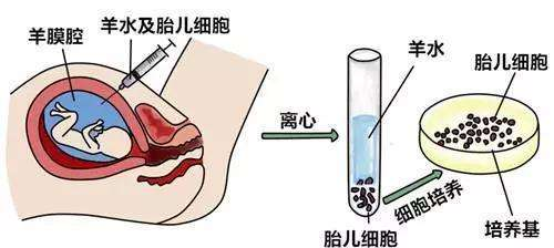 高龄妇女如何做好孕期管理？你关心的6个问题都有答案