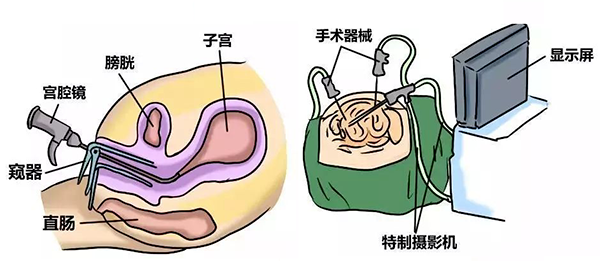 过筛的囊胚，为什么还会胎停？