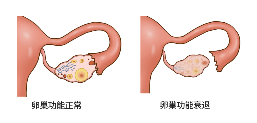 看不懂性激素六项和AMH检测报告？这篇文章教你！