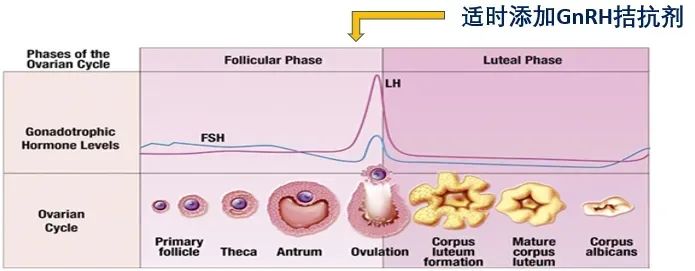 高龄做试管，选对促排方案是第一步！