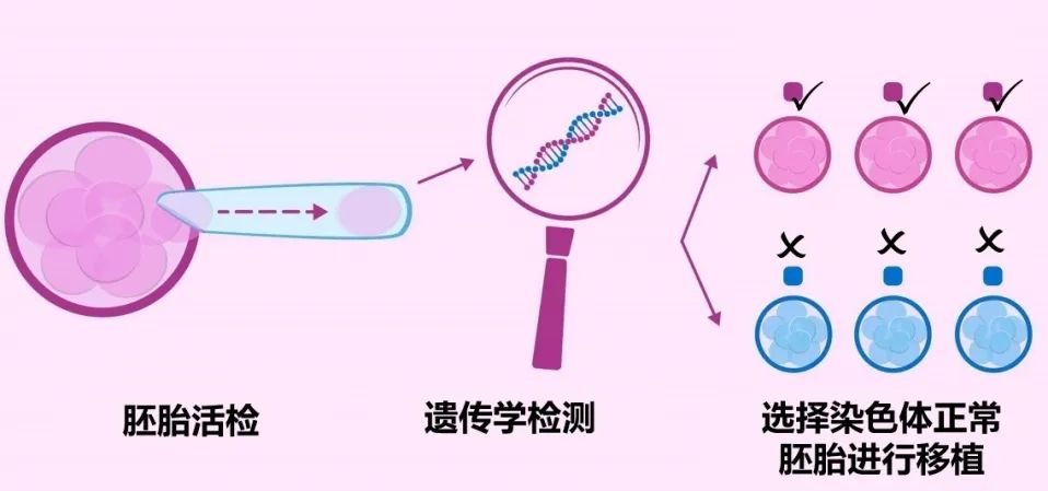 这项试管新技术真的能解决大龄卵少的难题？