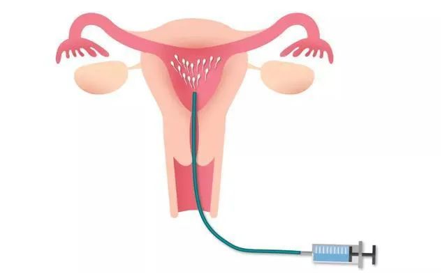 夫妻俩检查都没异常但就是怀不上，这是为啥？