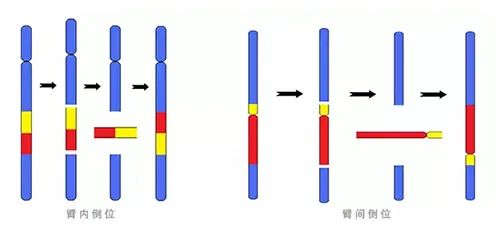 最易引发胎停的8个高危因素，你一定要知道！