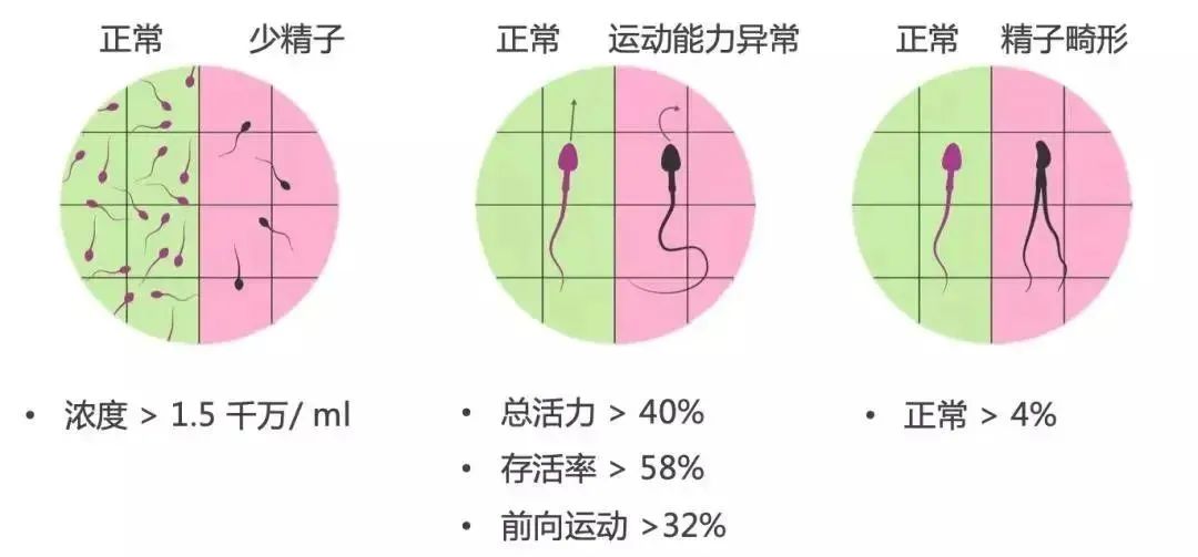 做试管，关于男性精子问题，看这篇就够了！