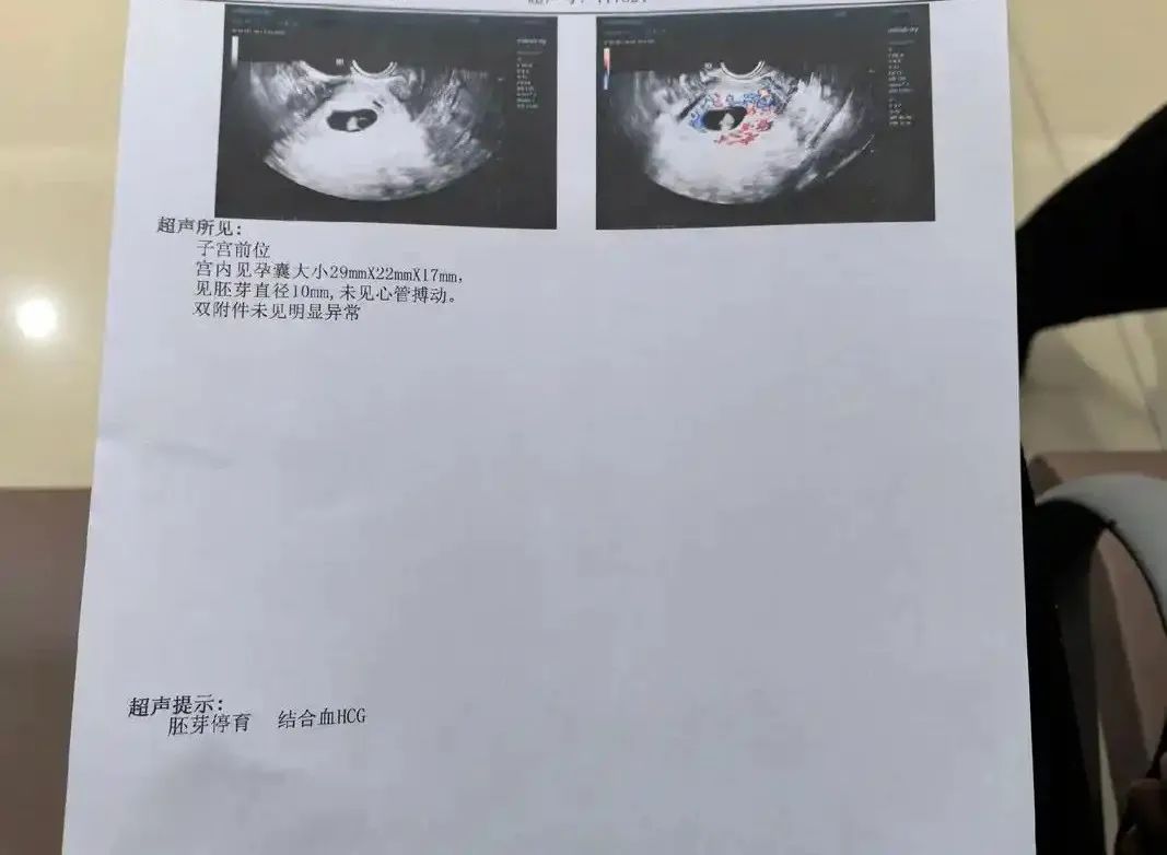 怀得上留不住？这6大“隐形杀手”要注意！
