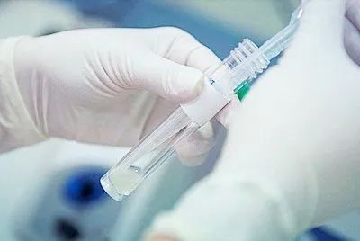 做试管，关于男性精子问题，看这篇就够了！