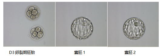 AA和6AA囊胚哪个更好？"