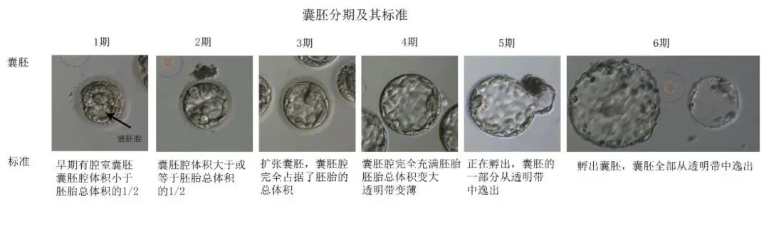 AA和6AA囊胚哪个更好？"