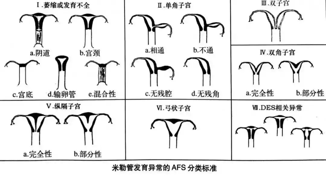 怀得上留不住？这6大“隐形杀手”要注意！