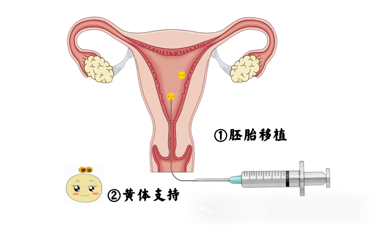 胚胎移植后，如何调整“吃、穿、住、行”？