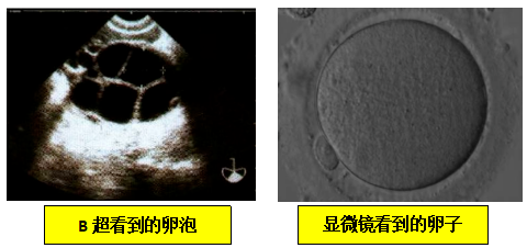 为什么卵泡数、取卵数、胚胎数，会层层"缩水"？