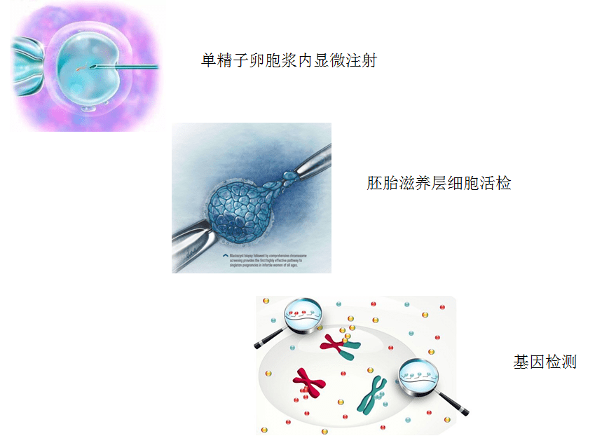 产检一路“绿灯”，为什么宝宝出生后还是有缺陷？