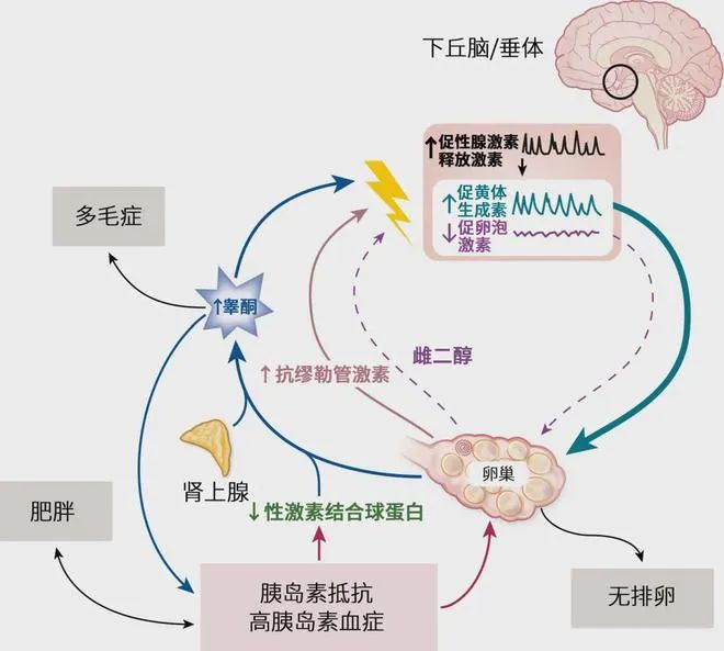 久备不孕？你的精子或卵子可能正在“摆烂”！