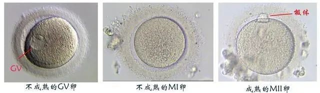 卵子成熟障碍，还有机会怀孕吗？