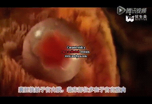 好胚胎、好内膜，为什么还着床失败？