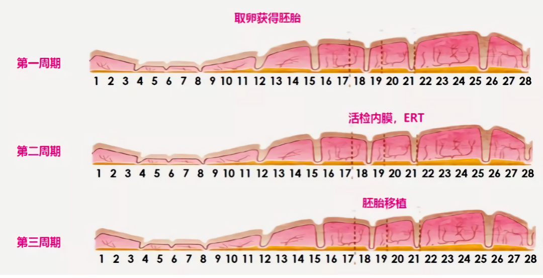 多次移植不着床？胚胎移植“黄金窗口”了解一下！