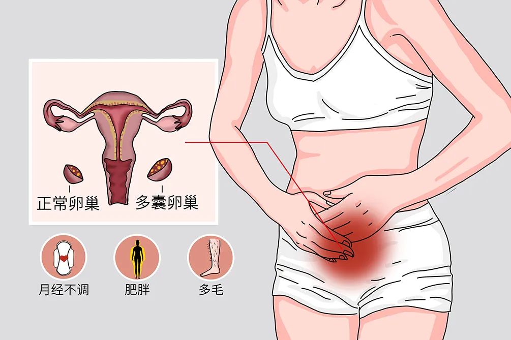 卵子成熟障碍，还有机会怀孕吗？