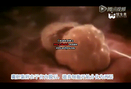 好胚胎、好内膜，为什么还着床失败？