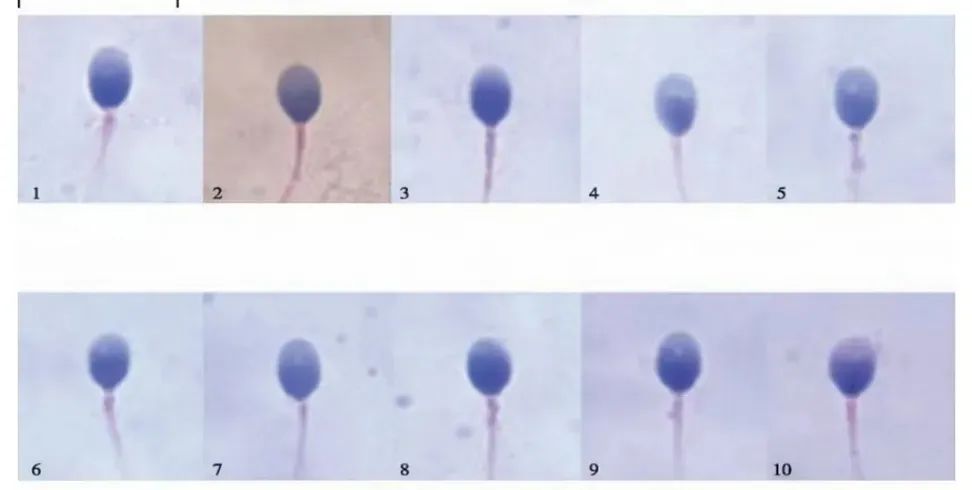 精子“选美”大赛揭秘：形态好，中奖率才高！​
