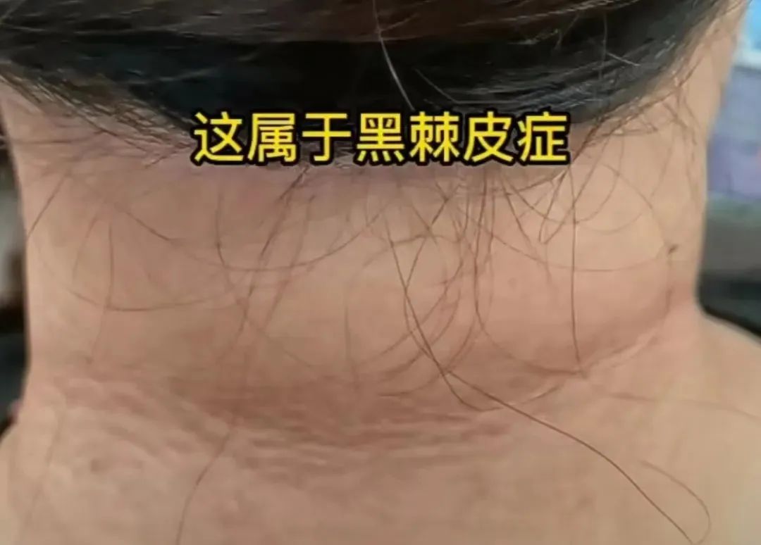 卵泡多却难怀孕？多囊卵巢患者要知道的真相！