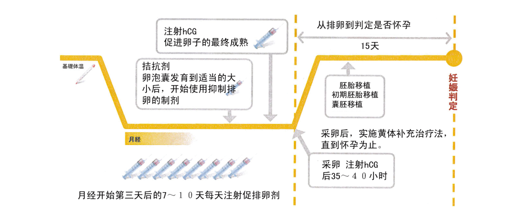 最全试管促排方案合集，哪种适合你？