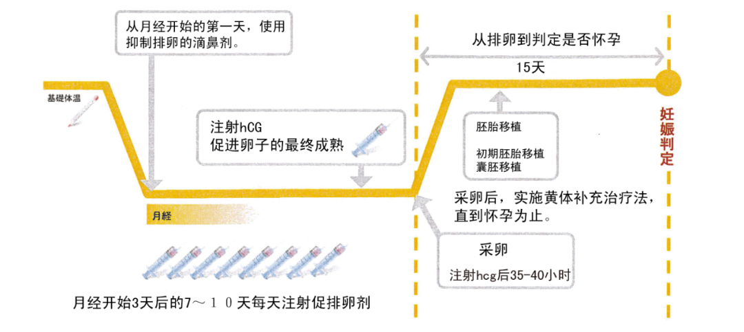 最全试管促排方案合集，哪种适合你？