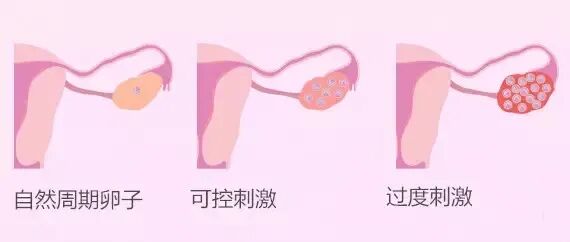 打促排针，会使我变丑变胖吗？