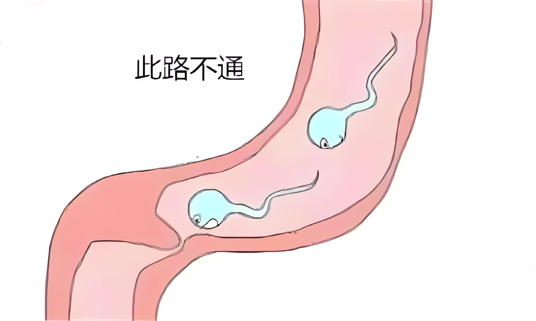 生不出娃，到底是谁的“锅”？