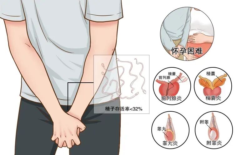 备孕总失败？可能是“小蝌蚪”不给力！