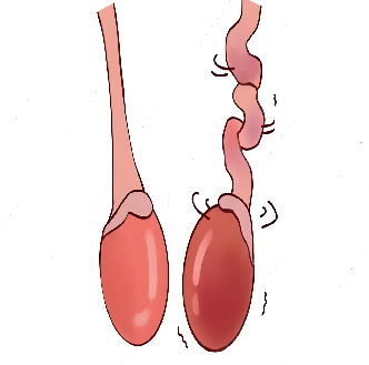 生不出娃，到底是谁的“锅”？