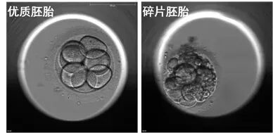 AA≠终极王者？是时候重新认识胚胎评分了…​"