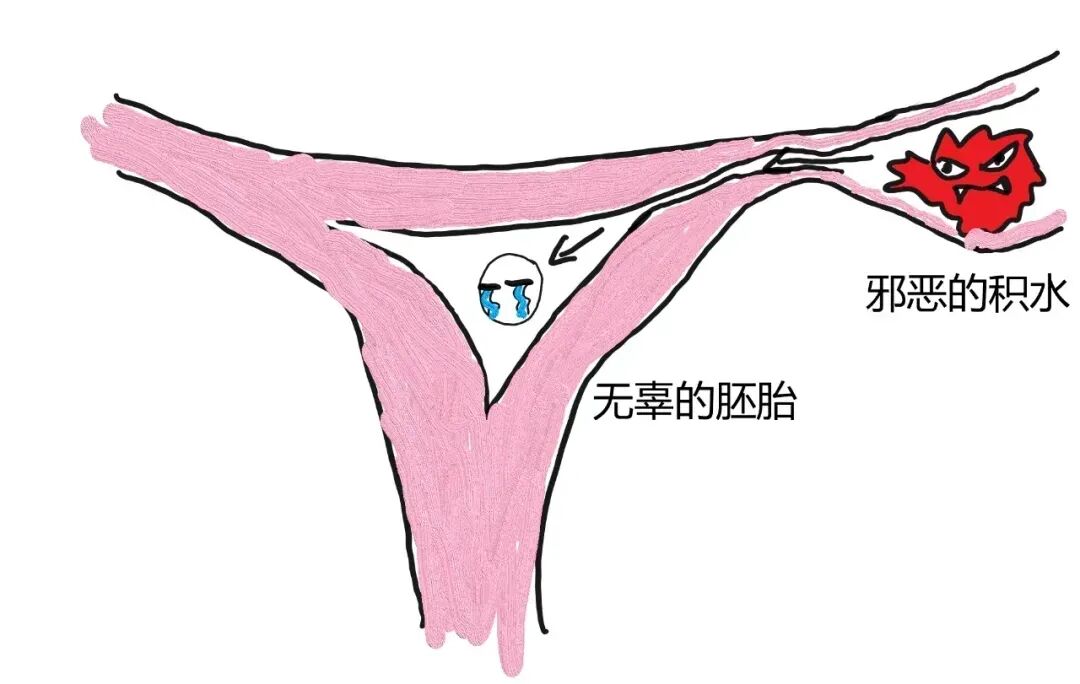 排卵期同房也怀不上？答案藏在这三个细节里~