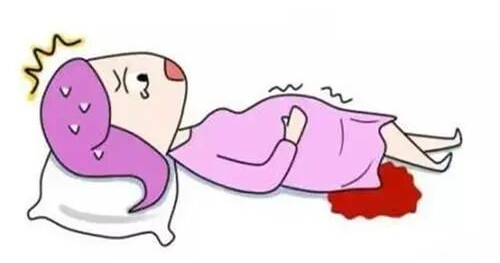 孕期的“小插曲”——妊娠期蜕膜息肉！