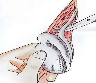 生不出娃，到底是谁的“锅”？