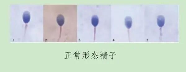 备孕别光顾着养卵！也给精子加点养分~