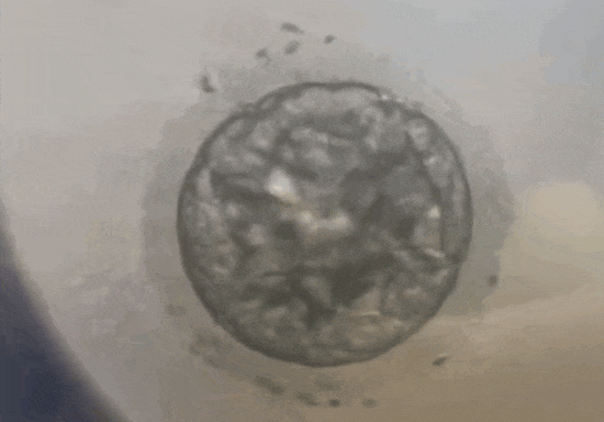 AA≠终极王者？是时候重新认识胚胎评分了…​"