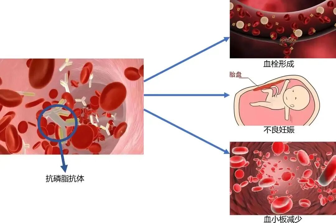 真相解读：你的胚胎为何止步于囊胚前？