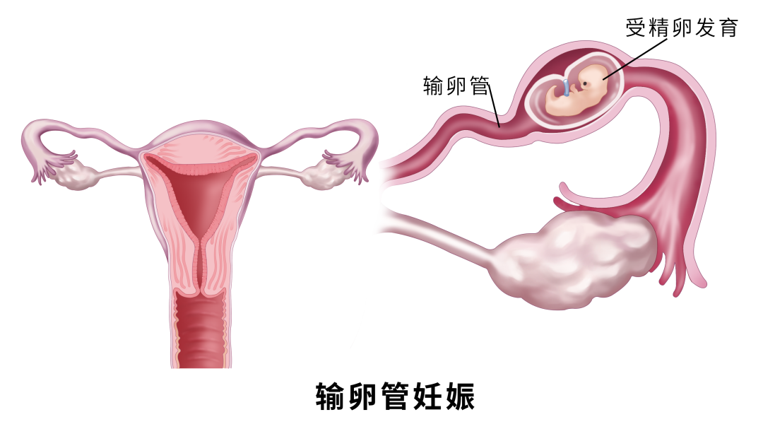 排卵期同房也怀不上？答案藏在这三个细节里~