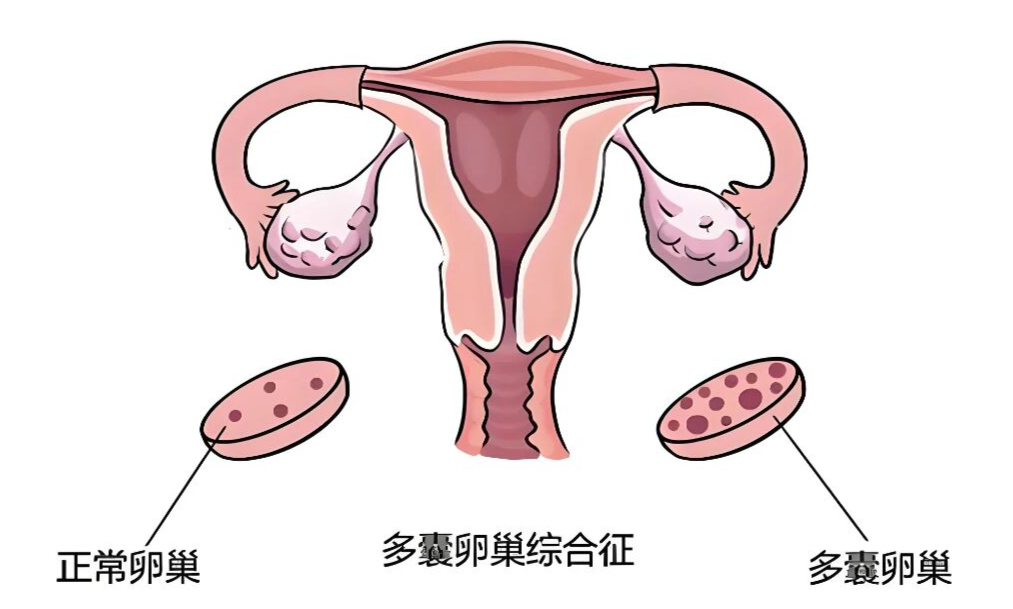 排卵期同房也怀不上？答案藏在这三个细节里~