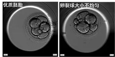 AA≠终极王者？是时候重新认识胚胎评分了…​"